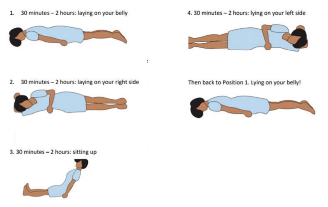 lateral side lying position